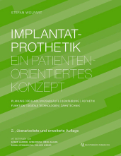 Implantatprothetik. 