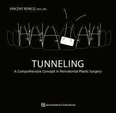 Tunneling. 