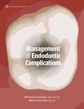 Management of Endodontic Complications. 