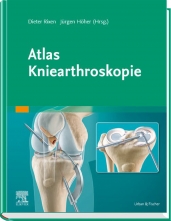 Atlas Kniearthroskopie. 